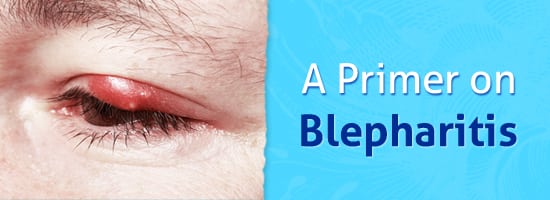 A-Primer-on-Blepharitis-Childrens-Eye-Center-OC
