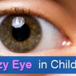 Lazy-Eye-in-Children1-Childrens-Eye-Center-OC