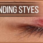 Understanding-Styes-Childrens-Eye-Center-OC