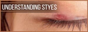 Understanding-Styes-Childrens-Eye-Center-OC