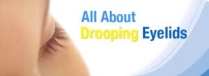 All-About-Drooping-Eyelids-Childrens-Eye-Center-OC