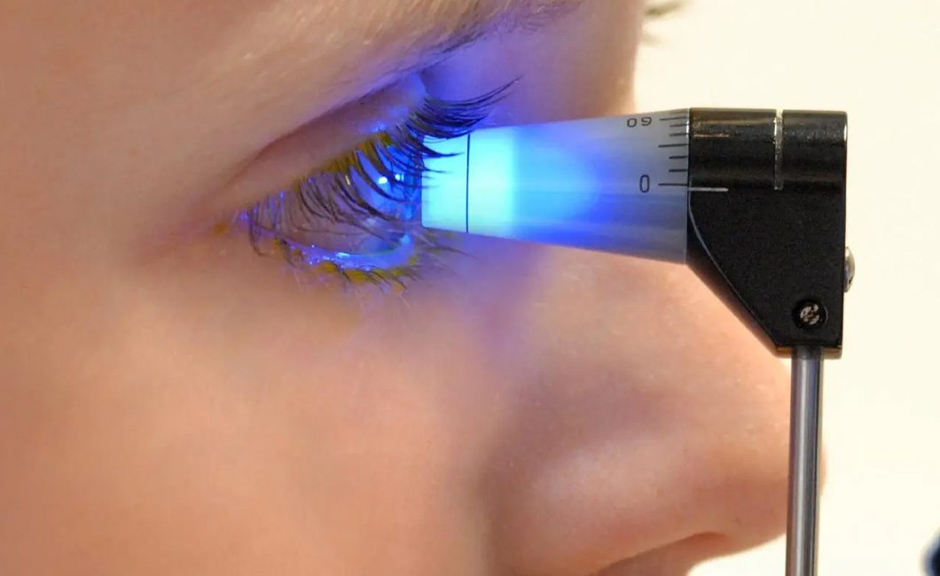 Glaucoma-Children’s-Eye-Center