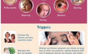 Allergic-Eye-Disease-in-Children-by-Childrens-Eye-Center-of-Orange-County