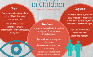 Lazy-Eye-in-Children-by-Childrens-Eye-Center-of-Orange-County